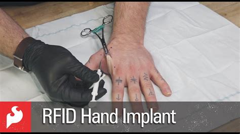 rfid implantation